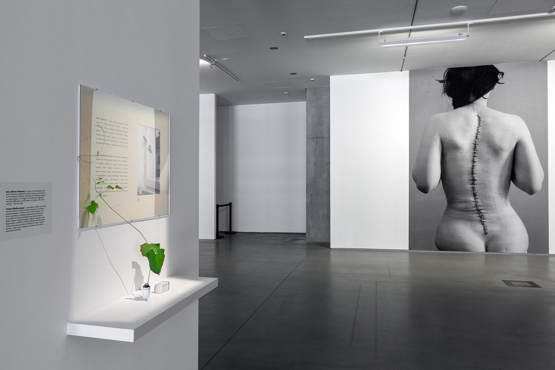 Wystawa //Medycyna w sztuce//, widoczne prace Oskara Dawickiego //Tranxene//, 2006 oraz Sophie Ristelhueber, //Every One #14//, 1994 //fot. Rafał Sosin