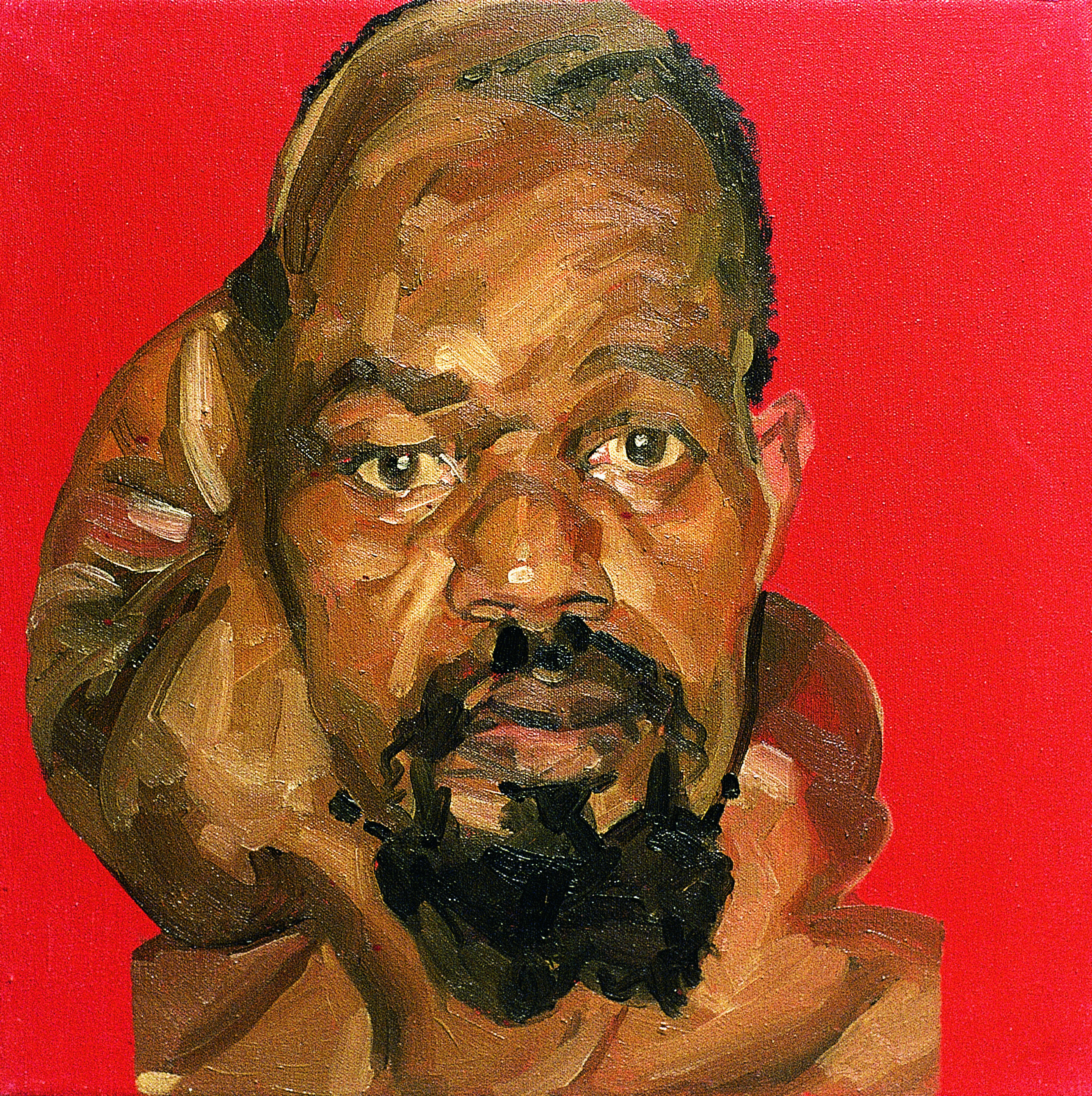 Mark Gilbert, //Hakeem S. (przed operacją)//, olej / płótno, 1999–2000, courtesy Saving Faces, Mark Gilbert, Professor Iain Hutchison