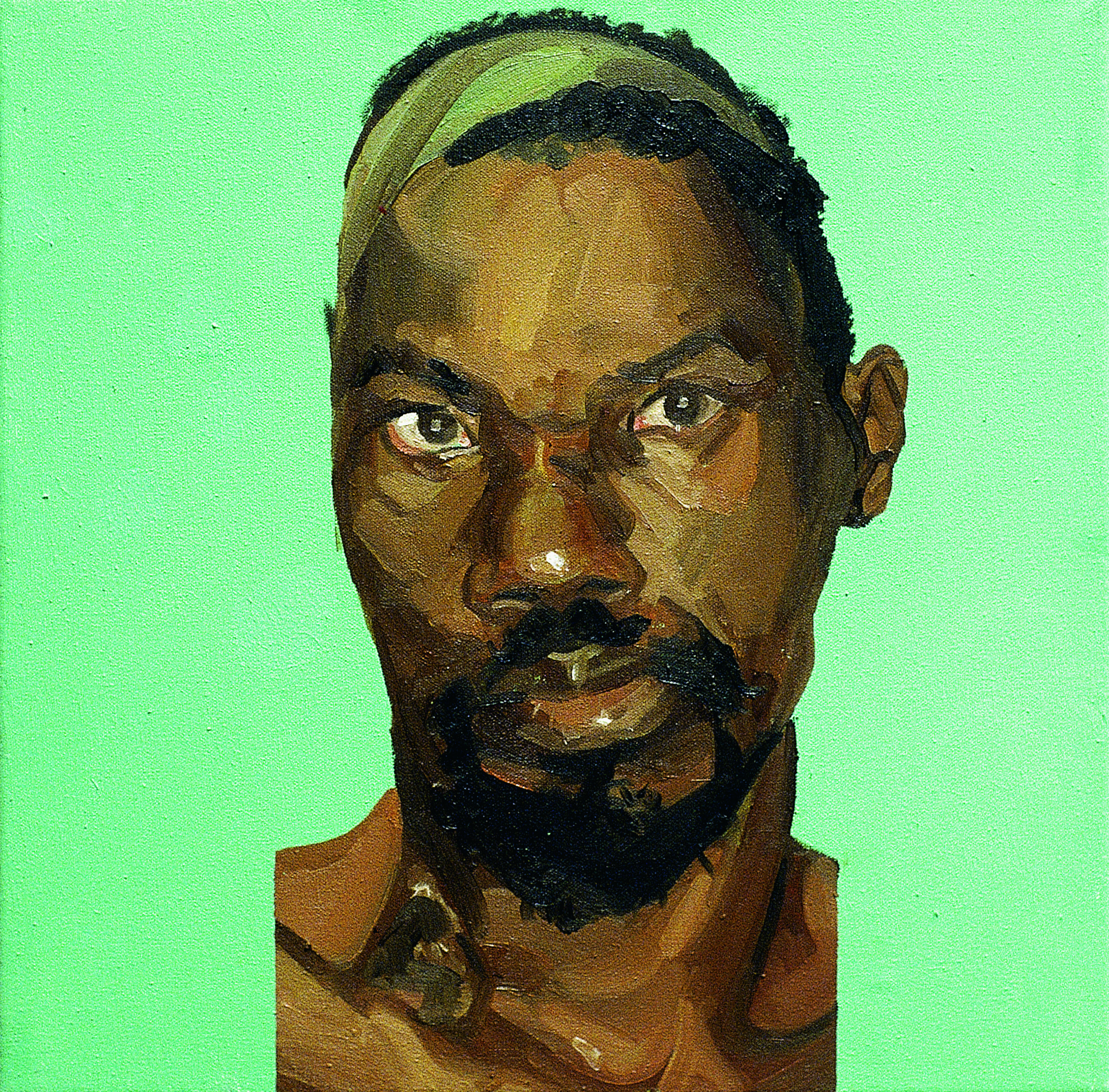 Mark Gilbert, //Hakeem S. (po operacji) I//, olej / płótno, 1999–2000, courtesy Saving Faces, Mark Gilbert, Professor Iain Hutchison