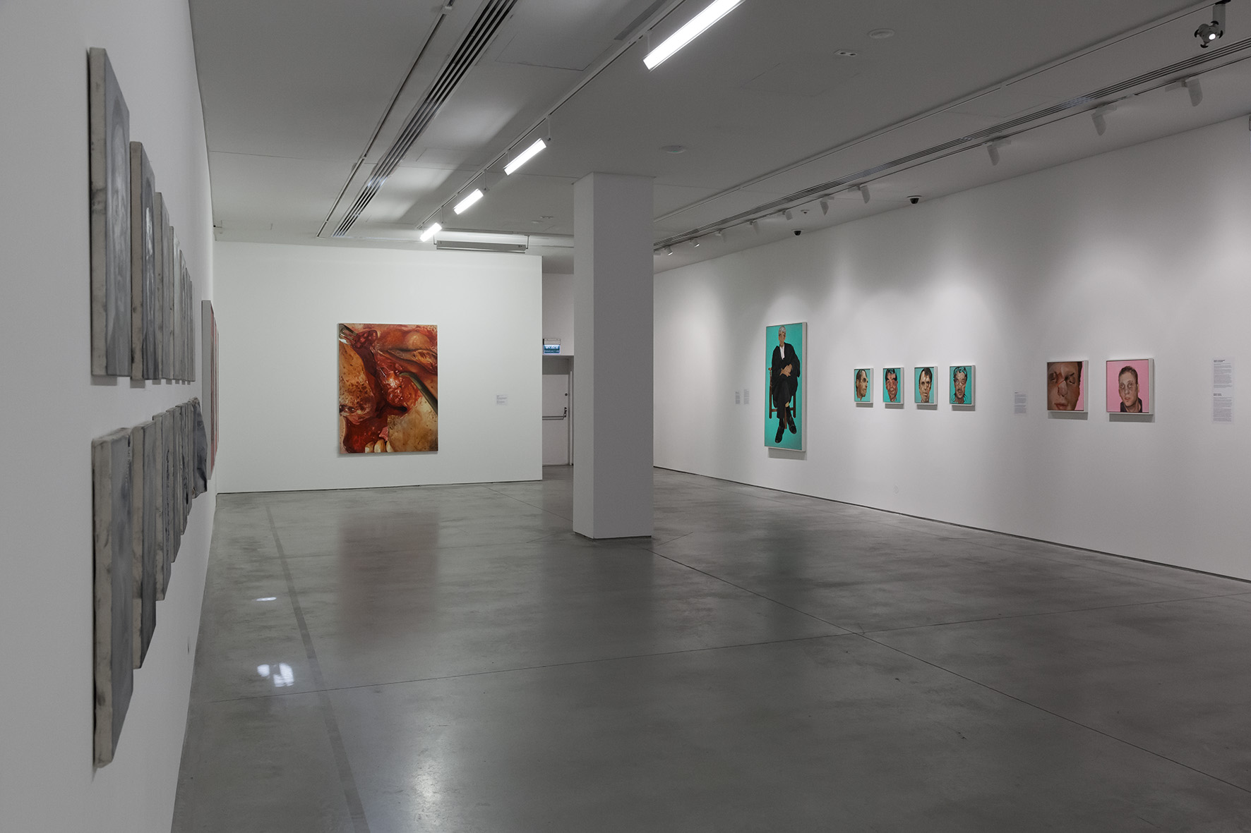 //Medicine in Art// exhibition